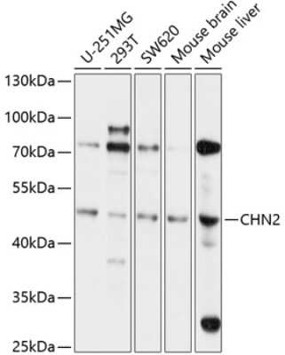 Western Blot: Chimaerin 2 AntibodyAzide and BSA Free [NBP2-92581]